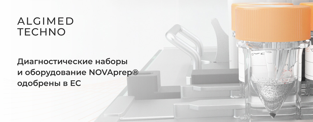 Диагностические наборы и оборудование NOVAprep® одобрены в ЕС!
