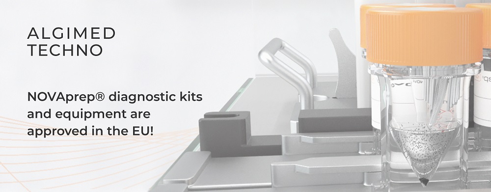 NOVAprep® diagnostic kits and equipment are approved in the EU!